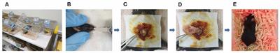 Surgery Performed Under Propofol Anesthesia Induces Cognitive Impairment and Amyloid Pathology in ApoE4 Knock-In Mouse Model